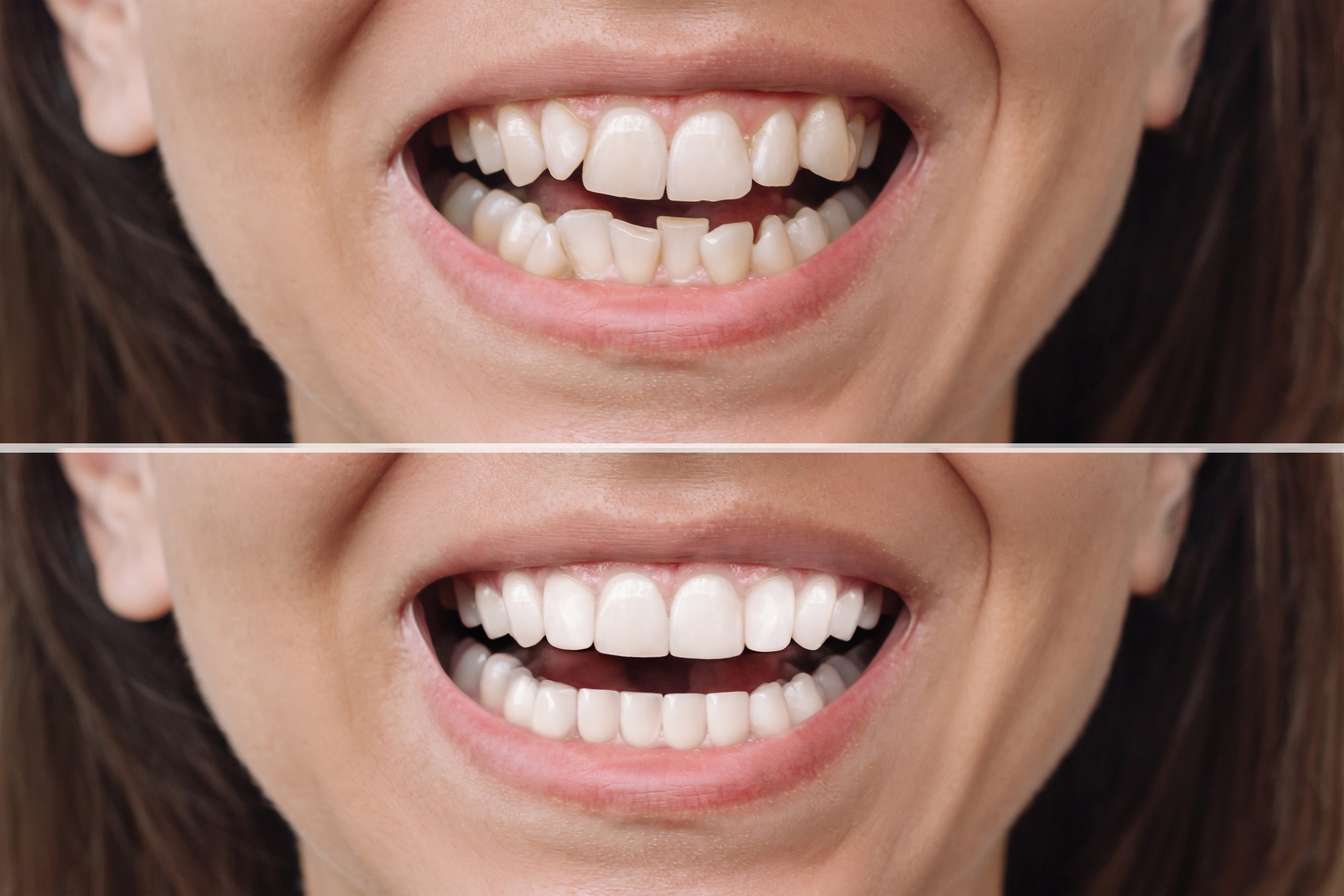 Orthodontics for children and teens at Plaza Pointe Dental Specialists