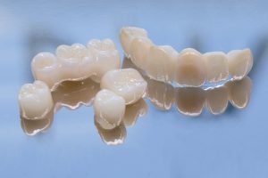 dental crowns and bridges