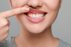 woman showing her gums