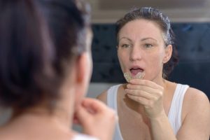 woman putting in mouthguard