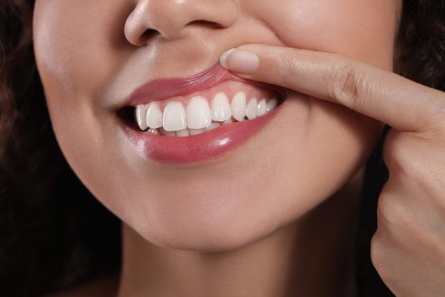 woman pulling back lip to reveal healthy gums