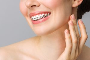 woman with braces